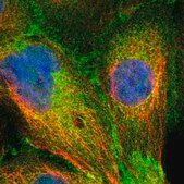 Anti-SLK antibody produced in rabbit Prestige Antibodies® Powered by Atlas Antibodies, affinity isolated antibody, buffered aqueous glycerol solution