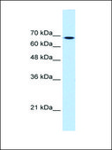 Anti-TGM2 (AB1) antibody produced in rabbit affinity isolated antibody