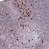 Anti-IL18BP antibody produced in rabbit Prestige Antibodies® Powered by Atlas Antibodies, affinity isolated antibody, buffered aqueous glycerol solution
