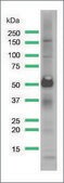 Anti-CD25 antibody, Rabbit monoclonal recombinant, expressed in proprietary host, clone SP176, affinity isolated antibody