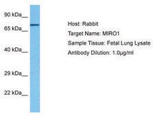 Anti-RHOT1 antibody produced in rabbit affinity isolated antibody