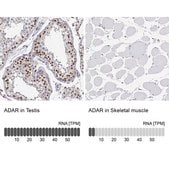 Anti-ADAR antibody produced in rabbit Prestige Antibodies® Powered by Atlas Antibodies, affinity isolated antibody, buffered aqueous glycerol solution