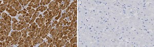 Anti-MLC-2 Antibody, clone 1B16 ZooMAb® Rabbit Monoclonal recombinant, expressed in HEK 293 cells