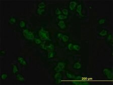 Monoclonal Anti-GBA antibody produced in mouse clone 2e2, purified immunoglobulin, buffered aqueous solution