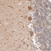 Anti-AFDN antibody produced in rabbit Prestige Antibodies® Powered by Atlas Antibodies, affinity isolated antibody, buffered aqueous glycerol solution, ab2