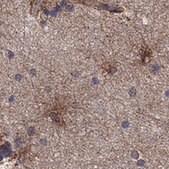 Anti-NTRK2 antibody produced in rabbit Prestige Antibodies® Powered by Atlas Antibodies, affinity isolated antibody, buffered aqueous glycerol solution