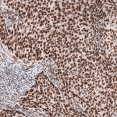 Monoclonal Anti-Smarca4 Antibody Produced In Mouse Prestige Antibodies® Powered by Atlas Antibodies, clone CL13783, affinity isolated antibody, buffered aqueous glycerol solution