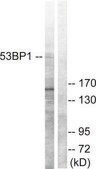 Anti-53BP1 antibody produced in rabbit affinity isolated antibody
