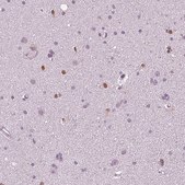 Monoclonal Anti-SOX9 antibody produced in mouse Prestige Antibodies® Powered by Atlas Antibodies, clone CL0639, purified immunoglobulin, buffered aqueous glycerol solution