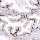 Monoclonal Anti-Smarcb1 Antibody Produced In Mouse Prestige Antibodies® Powered by Atlas Antibodies, clone CL14017, affinity isolated antibody, buffered aqueous glycerol solution