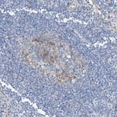Anti-TNS2 antibody produced in rabbit Prestige Antibodies® Powered by Atlas Antibodies, affinity isolated antibody, buffered aqueous glycerol solution