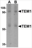 Anti-TEM1 (ab1) antibody produced in rabbit affinity isolated antibody, buffered aqueous solution