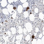 Anti-ITGA2B antibody produced in rabbit Prestige Antibodies® Powered by Atlas Antibodies, affinity isolated antibody, buffered aqueous glycerol solution