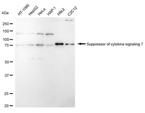 Anti Suppressor Of Cytokine Signaling 7 Antibody, clone 24GB1820, Rabbit Monoclonal clone 24GB1820, recombinant rabbit monoclonal, expressed in HEK293 cells