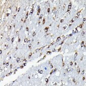 Anti- TTC11/FIS1 antibody produced in rabbit