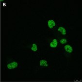Anti-Olig2 Antibody, clone 1K2 ZooMAb® Rabbit Monoclonal recombinant, expressed in HEK 293 cells