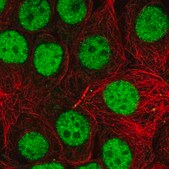 Anti-TARBP2 antibody produced in rabbit Prestige Antibodies® Powered by Atlas Antibodies, affinity isolated antibody, buffered aqueous glycerol solution