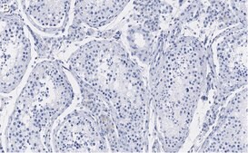 Anti-FMR1 (C-terminal) Antibody, clone 2B16 ZooMAb® Rabbit Monoclonal recombinant, expressed in HEK 293 cells