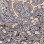 Monoclonal Anti-UCHL1 antibody produced in mouse Prestige Antibodies® Powered by Atlas Antibodies, clone CL3210, purified immunoglobulin, buffered aqueous glycerol solution