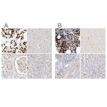 Anti-GCA antibody produced in rabbit Prestige Antibodies® Powered by Atlas Antibodies, affinity isolated antibody, buffered aqueous glycerol solution