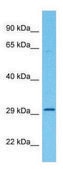 Anti-CD63 (C-terminal) antibody produced in rabbit affinity isolated antibody