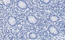 Anti-CTLA4/CD152 Antibody, clone 1D10 ZooMAb® Rabbit Monoclonal recombinant, expressed in HEK 293 cells