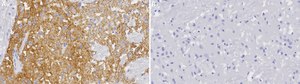 Anti-Dopamine Transporter Antibody, clone 1D2 ZooMAb® Rabbit Monoclonal recombinant, expressed in HEK 293 cells