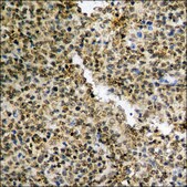 Anti-phospho-STAT3 (pTyr705) antibody produced in rabbit affinity isolated antibody
