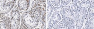 Anti-FMR1 (C-terminal) Antibody, clone 2B16 ZooMAb® Rabbit Monoclonal recombinant, expressed in HEK 293 cells