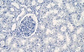 Anti-THSD7A Antibody, clone 2F15-L1 ZooMAb® Rabbit Monoclonal recombinant, expressed in HEK 293 cells