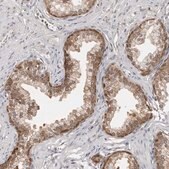 Anti-YWHAG antibody produced in rabbit Prestige Antibodies® Powered by Atlas Antibodies, affinity isolated antibody, buffered aqueous glycerol solution