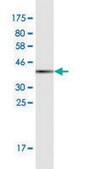 Monoclonal Anti-CRABP2 antibody produced in mouse clone 4F2, purified immunoglobulin, buffered aqueous solution