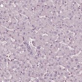 Anti-CHIT1 antibody produced in rabbit Prestige Antibodies® Powered by Atlas Antibodies, affinity isolated antibody, buffered aqueous glycerol solution