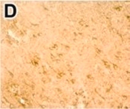 Anti-DNMT3B antibody produced in rabbit Prestige Antibodies® Powered by Atlas Antibodies, affinity isolated antibody, buffered aqueous glycerol solution