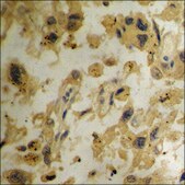 抗-磷酸化-ADAM 17 (pThr735) 兔抗 affinity isolated antibody