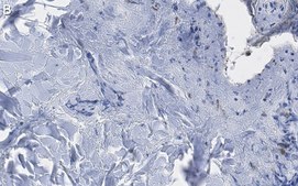 抗-胶原蛋白III型抗体，克隆3N18 ，ZooMAb®兔单克隆抗体 recombinant, expressed in HEK 293 cells