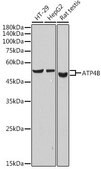 Anti-ATP4B antibody produced in rabbit