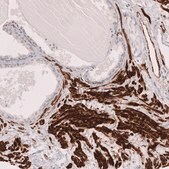 Monoclonal Anti-Myh11 Antibody Produced In Mouse Prestige Antibodies® Powered by Atlas Antibodies, clone CL14619, affinity isolated antibody, buffered aqueous glycerol solution