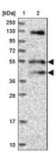 Anti-FUZ antibody produced in rabbit Prestige Antibodies® Powered by Atlas Antibodies, affinity isolated antibody, buffered aqueous glycerol solution