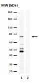Anti-Choline Transporter Antibody from rabbit, purified by affinity chromatography