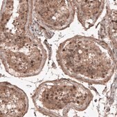 Monoclonal Anti-RBCK1 antibody produced in mouse Prestige Antibodies® Powered by Atlas Antibodies, clone CL4289, purified immunoglobulin