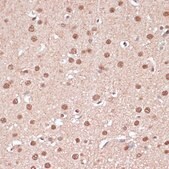 Anti- ITCH antibody produced in rabbit