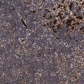 Anti-RECQL antibody produced in rabbit Prestige Antibodies® Powered by Atlas Antibodies, affinity isolated antibody, buffered aqueous glycerol solution