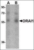 ORAI1单克隆抗体 小鼠抗 clone 3F6H5, purified immunoglobulin, buffered aqueous solution