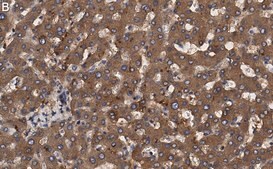 Anti-Transferrin Antibody, clone 2B8 , ZooMAb® Rabbit Monoclonal recombinant, expressed in HEK 293 cells