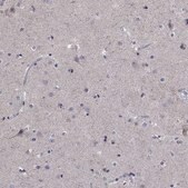 Anti-SDC1 antibody produced in rabbit Prestige Antibodies® Powered by Atlas Antibodies, affinity isolated antibody, buffered aqueous glycerol solution