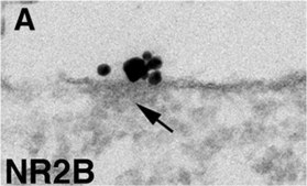 Anti-NMDAR2A&amp;B Antibody, pan Chemicon®, from rabbit