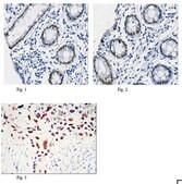 抗-KLF4抗体（克隆1E6） ascites fluid, clone 1E06, from mouse