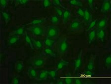 Monoclonal Anti-SMAD2 antibody produced in mouse clone 3G9, purified immunoglobulin, buffered aqueous solution