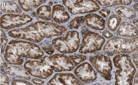 Anti-ULK2 Antibody, clone 3E19 ZooMAb® Rabbit Monoclonal recombinant, expressed in HEK 293 cells